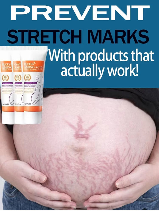 Stretch Marks Permanent Removal Cream Eliminate Body Belly Stretch Marks Swelling Marks Remove Skin Cracks Repair Firming Care